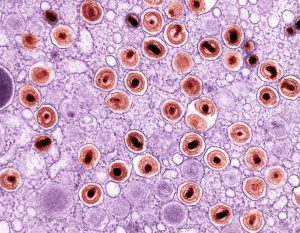 New Breakthrough Could Neutralize Silent Epstein-Barr Virus